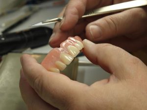 helper Denture Repair