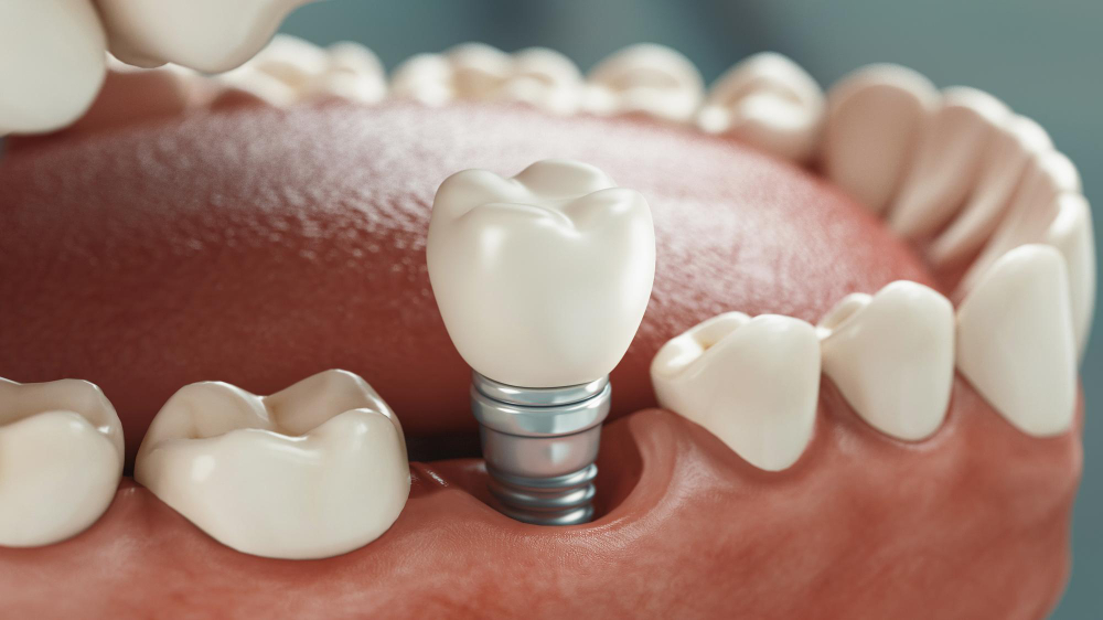 Parkway Dental | Helper Dentist