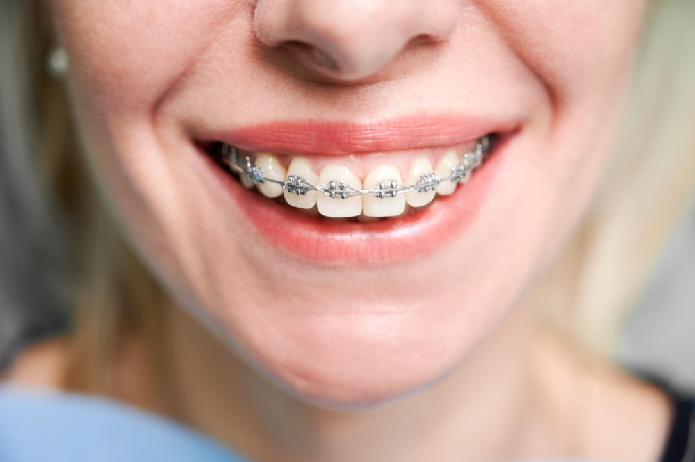 Parkway Dental | Helper Dentist